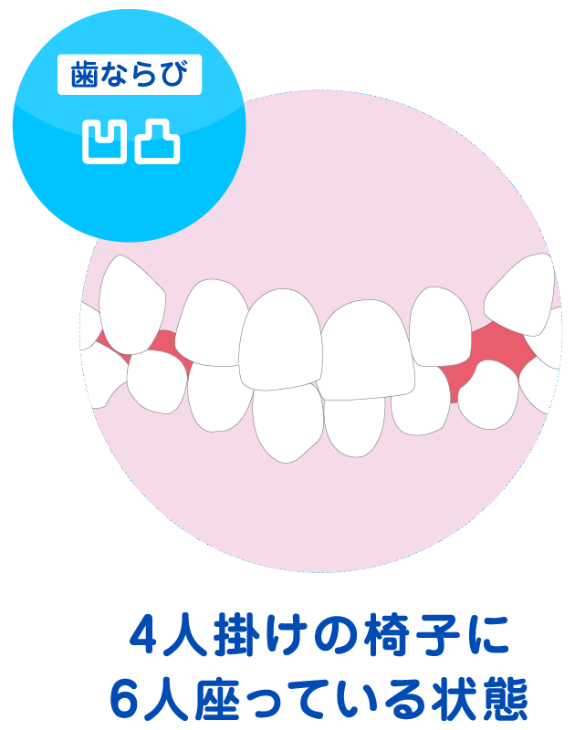凹凸